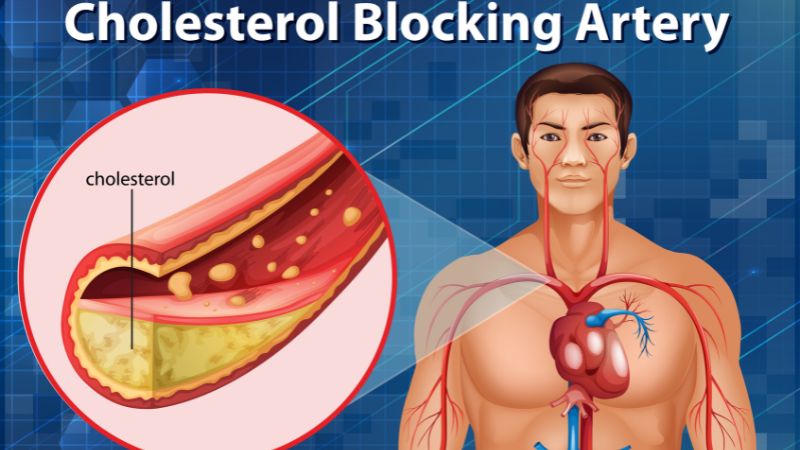 প্রাকৃতিক উপায়ে রক্তে কোলেস্টেরল কমাবেন যে উপায়ে